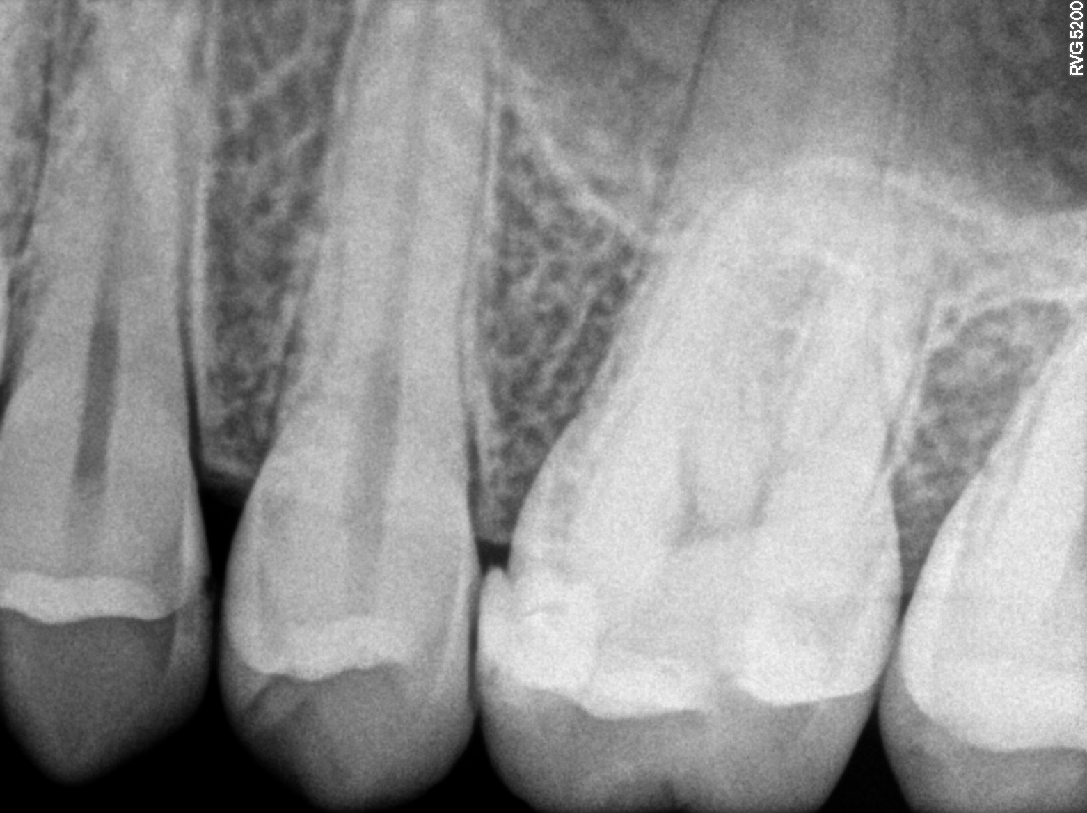 Dental X-ray